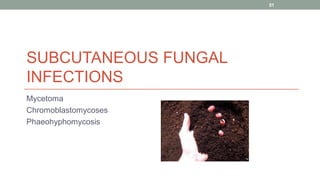 SUBCUTANEOUS FUNGAL
INFECTIONS
Mycetoma
Chromoblastomycoses
Phaeohyphomycosis
51
 