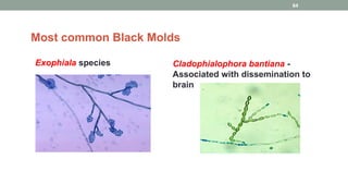 Exophiala species
Most common Black Molds
Cladophialophora bantiana -
Associated with dissemination to
brain
64
 