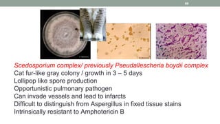Scedosporium complex/ previously Pseudallescheria boydii complex
Cat fur-like gray colony / growth in 3 – 5 days
Lollipop like spore production
Opportunistic pulmonary pathogen
Can invade vessels and lead to infarcts
Difficult to distinguish from Aspergillus in fixed tissue stains
Intrinsically resistant to Amphotericin B
69
 