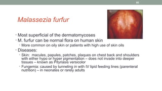 Malassezia furfur
• Most superficial of the dermatomycoses
• M. furfur can be normal flora on human skin
• More common on oily skin or patients with high use of skin oils
• Diseases:
• Skin: macules, papules, patches, plaques on chest back and shoulders
with either hypo or hyper pigmentation – does not invade into deeper
tissues – known as Pityriasis versicolor
• Fungemia: caused by tunneling in with IV lipid feeding lines (parenteral
nutrition) – in neonates or rarely adults
85
 
