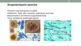Scopulariopsis species
•Found in soil and grows on plant
•Infections: Nail, skin, sinusitis, pulmonary and may
disseminate...