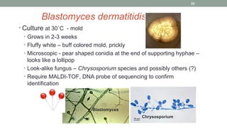 Blastomyces dermatitidis
• Culture at 30˚C - mold
• Grows in 2-3 weeks
• Fluffy white – buff colored mold, prickly
• Micro...