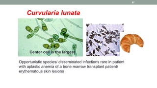 Curvularia lunata
Center cell is the largest
Opportunistic species/ disseminated infections rare in patient
with aplastic ...