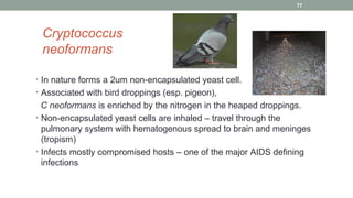 Cryptococcus
neoformans
• In nature forms a 2um non-encapsulated yeast cell.
• Associated with bird droppings (esp. pigeon...