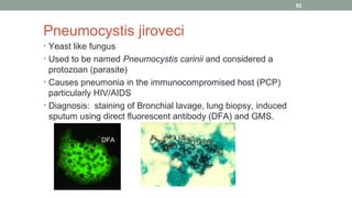 Pneumocystis jiroveci
• Yeast like fungus
• Used to be named Pneumocystis carinii and considered a
protozoan (parasite)
• ...