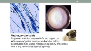 Microsporum canis
Ringworm infection acquired infected dog or cat
White colony/ yellow on reverse (back) of colony
Tubercu...