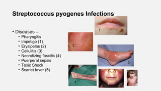 Streptococcus pyogenes Infections
• Diseases –
• Pharyngitis
• Impetigo (1)
• Erysipelas (2)
• Cellulitis (3)
• Necrotizing fascitis (4)
• Puerperal sepsis
• Toxic Shock
• Scarlet fever (5)
1
2
3
4
5
 