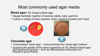 Most commonly used agar media
Blood agar- 5% sheep’s blood agar
• Gauge hemolytic reaction of bacteria (alpha, beta, gamma)
• Culture a variety of Gram positive, Gram negative bacteria and Yeast
Chocolate agar
• “Caramelized” blood agar – more enriched than blood agar medium
• Supports the growth of the same organisms as 5% Sheep’s blood agar
plus fastidious bacteria – such as Haemophilus influenzae and
Neisseria gonorrhoeae
 