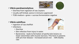 • Vibrio parahaemolyticus
• Diarrhea from ingestion of raw /oysters
• Usually self limited, worse in immune suppressed
• TCBS medium = green = sucrose fermentation negative
• Vibrio vulnificus
• Ingestion of raw shellfish
• Infections:
• Diarrhea
• Skin infection from injury in water
• Bacteremia - leads to formation of painful skin lesions on
lower extremities with muscle necrosis / This form in patients
with pre liver disease – increased serum iron - 50% fatality
rate
 