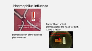 Haemophilus influenza
Growth only between X
and V strips
Staph aureus supplies the
X and V factors required
Factor X and V test:
Demonstrates the need for both
X and V factor
Demonstration of the satellite
phenomenon
 