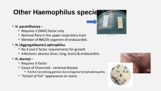 Other Haemophilus species
• H. parainfluenza –
• Requires V (NAD) factor only
• Norrmal flora in the upper respiratory tract
• Member of HACEK organism of endocarditis
• H. (Aggregatibacter) aphrophilus
• No X and V factor requirements for growth
• Infections: abscess (liver, lung, brain) & endocarditis
• H. ducreyi –
• Requires X factor
• Cause of Chancroid - venereal disease
• Painful necrotizing genital ulcers/inguinal lymphadenopathy
• “School of fish” appearance on stains
 