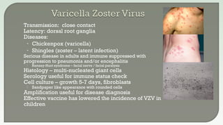  Transmission: close contact
 Latency: dorsal root ganglia
 Diseases:
• Chickenpox (varicella)
• Shingles (zoster – latent infection)
 Serious disease in adults and immune suppressed with
progression to pneumonia and/or encephalitis
 Ramsay-Hunt syndrome – facial nerve / facial paralysis
 Histology – multi-nucleated giant cells
 Serology useful for immune status check
 Cell culture – growth 5-7 days, fibroblasts
 Sandpaper like appearance with rounded cells
 Amplification useful for disease diagnosis
 Effective vaccine has lowered the incidence of VZV in
children
 