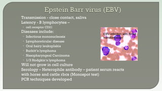  Transmission - close contact, saliva
 Latency - B lymphocytes –
• cell receptor CD21
 Diseases include:
• Infectious mononucleosis
• Lymphoreticular disease
• Oral hairy leukoplakia
• Burkitt’s lymphoma
• Nasopharyngeal Carcinoma
• 1/3 Hodgkin’s lymphoma
 Will not grow in cell culture
 Serology – Heterophile antibody – patient serum reacts
with horse and cattle rbcs (Monospot test)
 PCR techniques developed
EBV infection with B cell
transformation
 