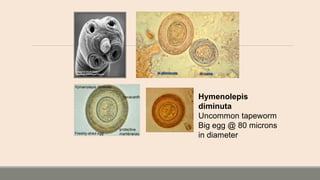 Hymenolepis
diminuta
Uncommon tapeworm
Big egg @ 80 microns
in diameter
 