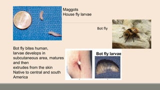 Maggots
House fly larvae
Bot fly larvae
Bot fly bites human,
larvae develops in
subcutaneous area, matures
and then
extrudes from the skin
Native to central and south
America
Bot fly
 