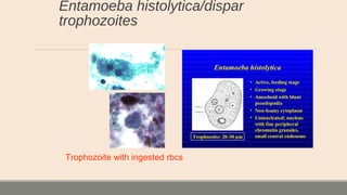 Entamoeba histolytica/dispar
trophozoites
Trophozoite with ingested rbcs
 