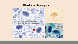 Giardia lamblia cysts
Clearing between the cell
wall and the cell membrane
 