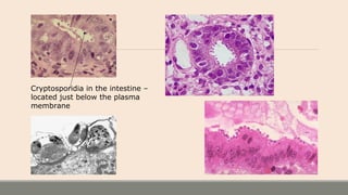 Cryptosporidia in the intestine –
located just below the plasma
membrane
 