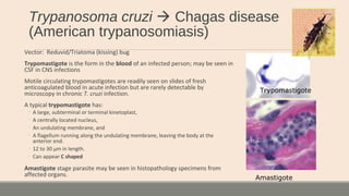 Trypanosoma cruzi  Chagas disease
(American trypanosomiasis)
Vector: Reduvid/Triatoma (kissing) bug
Trypomastigote is the form in the blood of an infected person; may be seen in
CSF in CNS infections
Motile circulating trypomastigotes are readily seen on slides of fresh
anticoagulated blood in acute infection but are rarely detectable by
microscopy in chronic T. cruzi infection.
A typical trypomastigote has:
◦ A large, subterminal or terminal kinetoplast,
◦ A centrally located nucleus,
◦ An undulating membrane, and
◦ A flagellum running along the undulating membrane, leaving the body at the
anterior end.
◦ 12 to 30 µm in length.
◦ Can appear C shaped
Amastigote stage parasite may be seen in histopathology specimens from
affected organs.
Trypomastigote
Amastigote
 