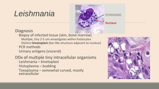 Leishmania
Diagnosis
◦Biopsy of infected tissue (skin, bone marrow)
◦Multiple, tiny 2-5 um amastigotes within histiocytes
◦Distinct kinetoplast (bar-like structure adjacent to nucleus)
◦PCR methods
◦Urinary antigens (visceral)
DDx of multiple tiny intracellular organisms
◦Leishmania – kinetoplast
◦Histoplasma – budding
◦Toxoplasma – somewhat curved, mostly
extracellular
 