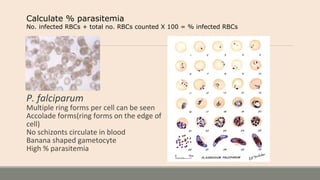 P. falciparum
Multiple ring forms per cell can be seen
Accolade forms(ring forms on the edge of
cell)
No schizonts circulate in blood
Banana shaped gametocyte
High % parasitemia
Calculate % parasitemia
No. infected RBCs + total no. RBCs counted X 100 = % infected RBCs
 