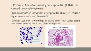 Primary Amoebic meningoencephalitis (PAM) is
caused by Naegleria fowleri
Granulomatous amoebic encephalitis (GAE) is caused
by Acanthamoeba and Balamuthia
Clinical scenario: swimming or diving into fresh-water pools
and water goes up nose thru cribriform plate
N. fowleri
trophozoite
 