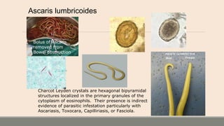 Ascaris lumbricoides
Charcot Leyden crystals are hexagonal bipyramidal
structures localized in the primary granules of the
cytoplasm of eosinophils. Their presence is indirect
evidence of parasitic infestation particularly with
Ascariasis, Toxocara, Capilliriasis, or Fasciola.
Bolus of Ascaris
removed from
Bowel obstruction
 