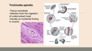 Trichinella spiralis
-Tissue nematode
-Infection from the ingestion
of undercooked meat
-Usually an incidental finding
in muscle
 