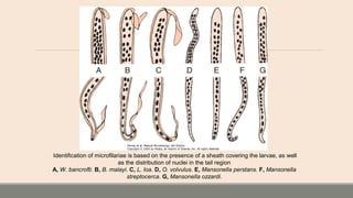 Identification of microfilariae is based on the presence of a sheath covering the larvae, as well
as the distribution of nuclei in the tail region
A, W. bancrofti. B, B. malayi. C, L. loa. D, O. volvulus. E, Mansonella perstans. F, Mansonella
streptocerca. G, Mansonella ozzardi.
 
