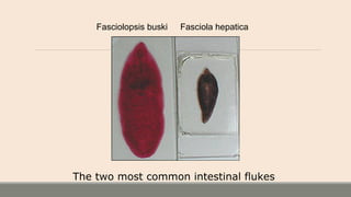 Fasciolopsis buski Fasciola hepatica
The two most common intestinal flukes
 