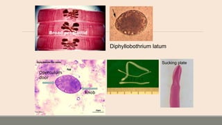 Diphyllobothrium latum
Operculum
door
knob
Sucking plate
Broad proglottid
 