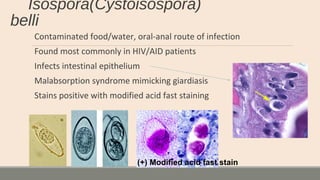 Isospora(Cystoisospora)
belli
Contaminated food/water, oral-anal route of infection
Found most commonly in HIV/AID patients
Infects intestinal epithelium
Malabsorption syndrome mimicking giardiasis
Stains positive with modified acid fast staining
(+) Modified acid fast stain
 