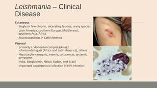 Leishmania – Clinical
Disease
Cutaneous
◦Single or few chronic, ulcerating lesions; many species
◦Latin America, southern Europe, Middle east,
southern Asia, Africa
◦Mucocutaneous in Latin America
Visceral
◦primarily L. donovani complex (Asia), L.
infantum/chagasi (Africa and Latin America), others
◦Hepatosplenomegaly, anemia, cytopenias, systemic
symptoms
◦India, Bangladesh, Nepal, Sudan, and Brazil
◦Important opportunistic infection in HIV infection
 