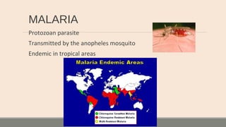 MALARIA
Protozoan parasite
Transmitted by the anopheles mosquito
Endemic in tropical areas
 