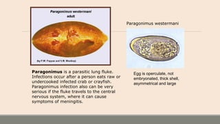 Egg is operculate, not
embryonated, thick shell,
asymmetrical and large
Paragonimus westermani
Paragonimus is a parasitic lung fluke.
Infections occur after a person eats raw or
undercooked infected crab or crayfish.
Paragonimus infection also can be very
serious if the fluke travels to the central
nervous system, where it can cause
symptoms of meningitis.
 