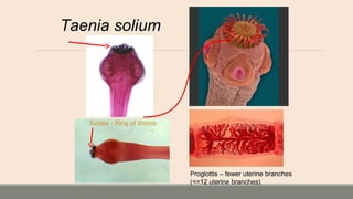 Taenia solium
Proglottis – fewer uterine branches
(<=12 uterine branches)
Scolex - Ring of thorns
 