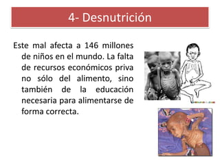 4- Desnutrición
Este mal afecta a 146 millones
de niños en el mundo. La falta
de recursos económicos priva
no sólo del alimento, sino
también de la educación
necesaria para alimentarse de
forma correcta.

 