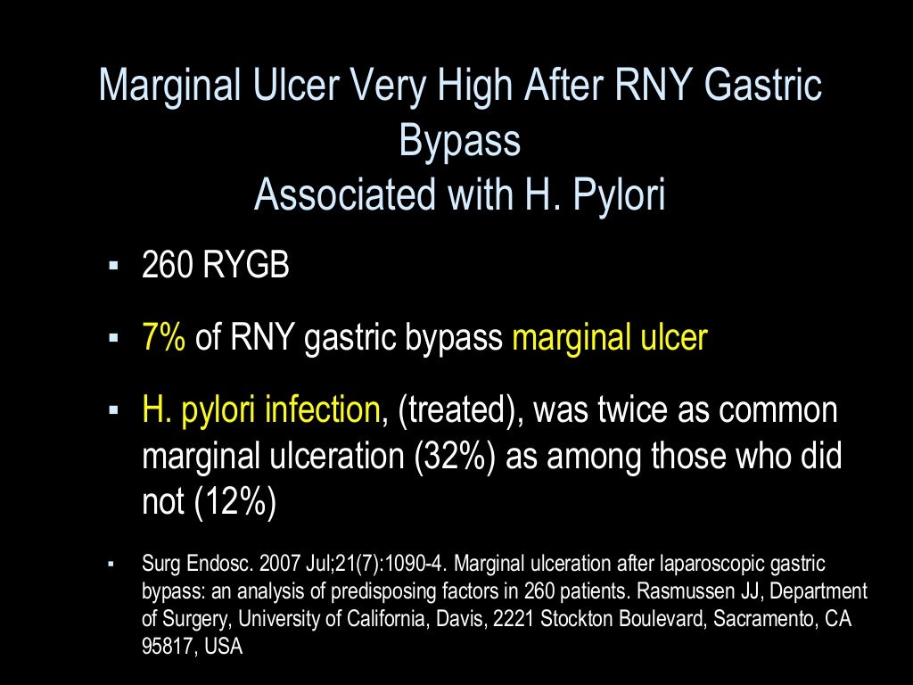 Marginal ulcer gastric bypass (MGB vs RNY)
