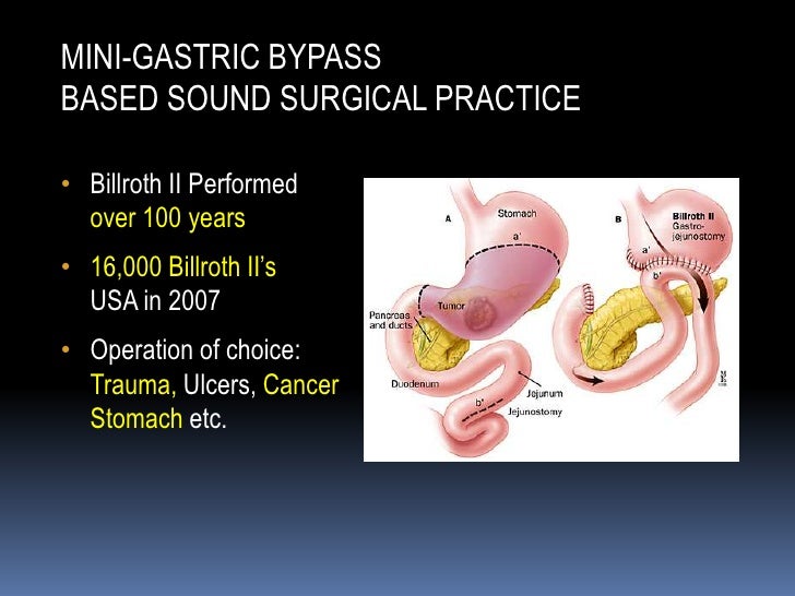 Presentation; Marginal ulcer gastric bypass