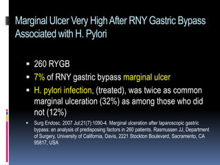 Marginal ulcer gastric bypass | PPTX