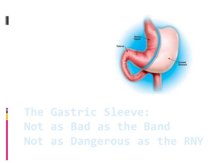 Marginal ulcer gastric bypass
