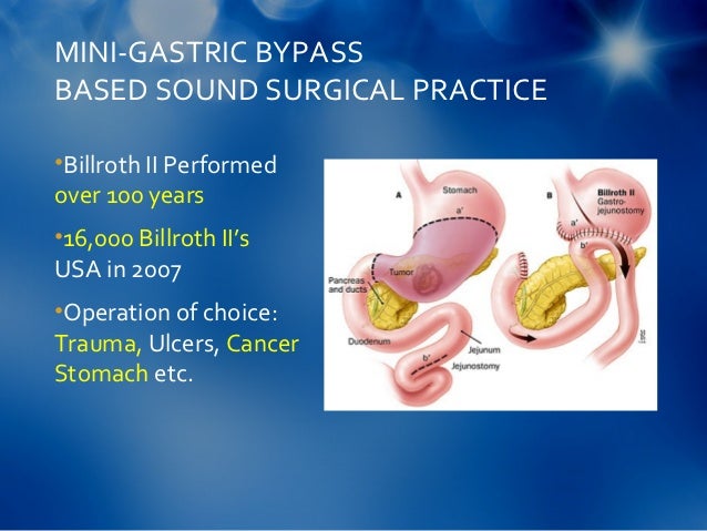 Marginal Ulcer after Gastric Bypass;