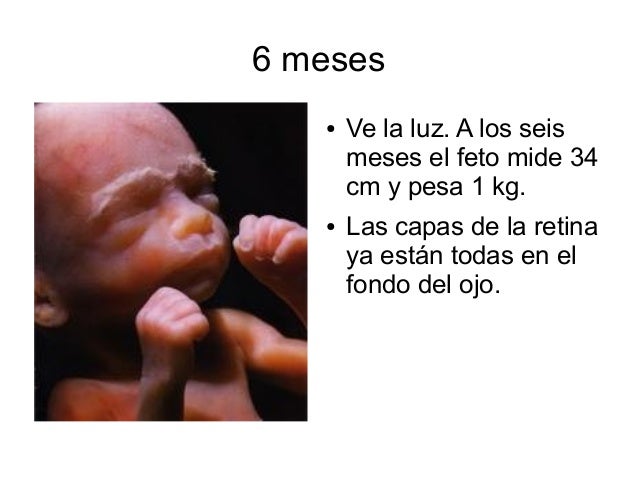 Bebe A Los 6 Meses De Gestacion - Consejos de Bebé