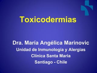 Toxicodermias

Dra. María Angélica Marinovic
 Unidad de Inmunología y Alergias
       Clínica Santa Maria
         Santiago - Chile
 