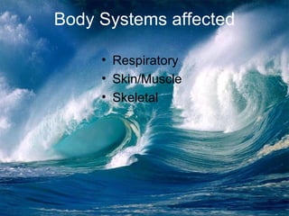 Body Systems affected Respiratory Skin/Muscle Skeletal 