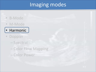 Imaging modes

•   B-Mode
•   M-Mode
•   Harmonic
•   Doppler
     – Spectral
     – Color Flow Mapping
     – Color Power
 