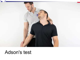 Adson's test
 