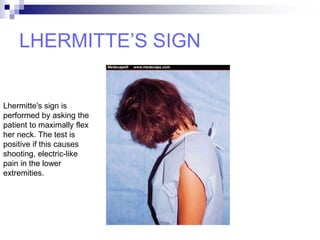 LHERMITTE’S SIGN
Lhermitte's sign is
performed by asking the
patient to maximally flex
her neck. The test is
positive if this causes
shooting, electric-like
pain in the lower
extremities.
 
