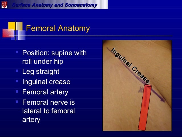Surface anatomy and sonoanatomy for the occasional regional anesthesi…