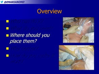 @EMARIANOMD
Overview
 Who can do it?
 What do you need?
 Where should you
place them?
 Why bother?
 How do you make i...